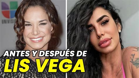 lis vega antes y después|Lis Vega, antes y después: su increíble cambio tras。